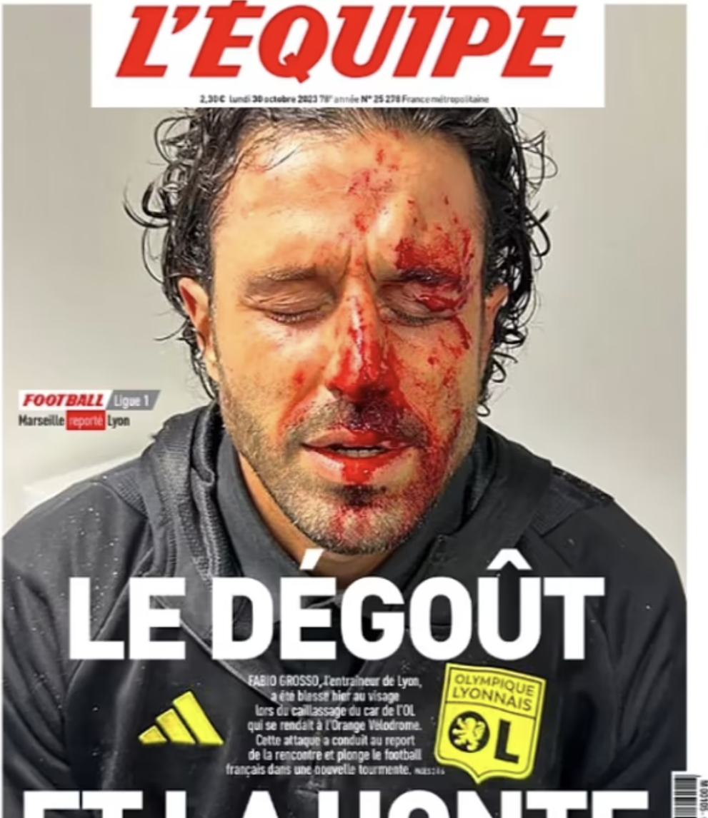 Bóng đá Pháp dậy sóng vì vụ tấn công xe buýt của Lyon